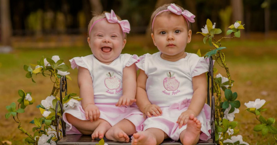 Em parto de gêmeas, mãe descobre que uma delas tem síndrome de Down