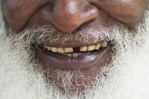 Idoso de barba branca sorrindo com um dente a menos