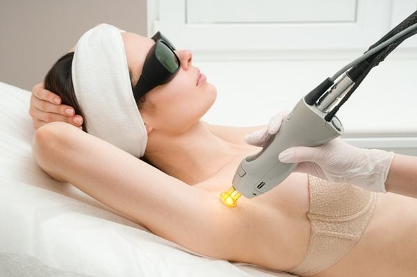 mulher fazendo depilação a laser na axila