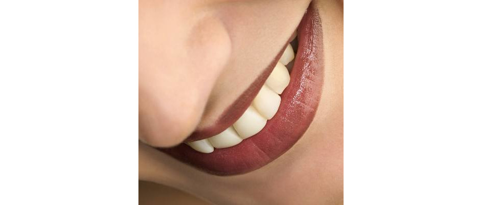 Dentes Brancos