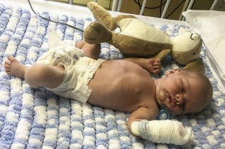 Após beijo de adulto, bebê de 9 dias contrai meningite e é internado - foto: Divulgação/DailyMail 