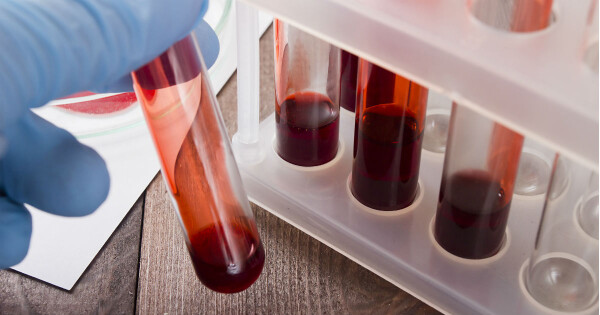 Cientistas conseguem transformar sangue tipo A em doador universal