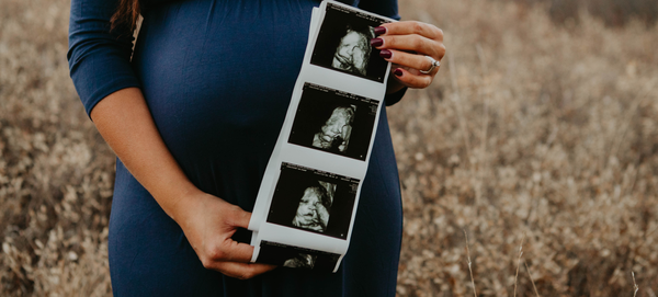 Mulher grávida posa para foto segurando imagens de ultrassom de seu bebê