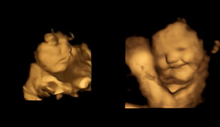Reação neutra do bebê, à esquerda, e reação sorrindo do bebê, à direita. Foto:&nbsp;Durham’s Fetal Neonatal Research Lab/Divulgação