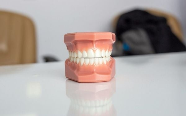 modelo de prótese dentária sobre a mesa