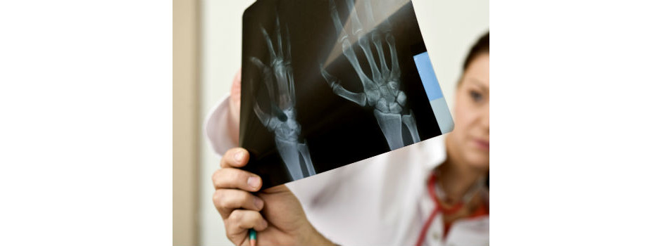 médica olhando raio-x de punho