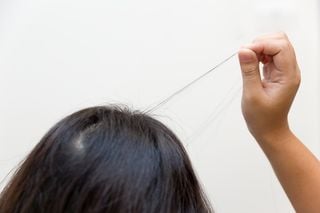 Close up da cabeça de uma pessoa que arranca fios de cabelo da própria cabeça