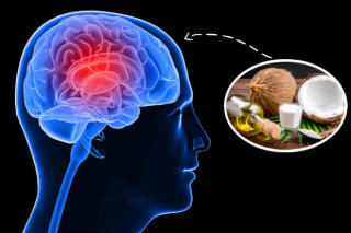 Entenda se existe relação entre Alzheimer e óleo de coco - Foto: Getty Images