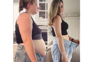Mulher perde 40 kg e mostra realidade da mudança do corpo - foto: divulgação/Instagram