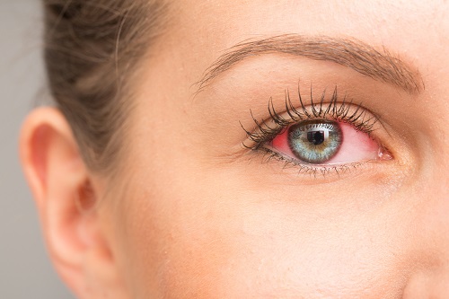 Saiba como fazer uma maquiagem simples para os olhos no dia a dia e dar um  up no olhar - Purepeople