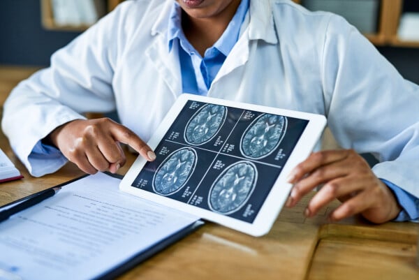 Médica mostrando resultado de exames de imagem no cérebro