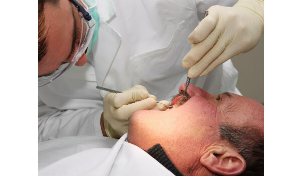Homem fazendo implante dentário