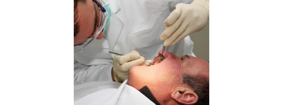 Homem fazendo implante dentário 