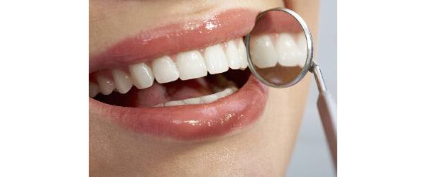 Tonalidade dos dentes