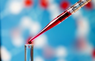 Exame de sangue pode descobrir câncer 10 anos antes de aparecer 