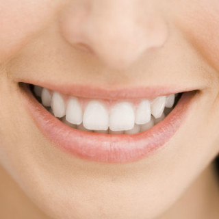 Sorriso com dentes brancos - Foto: Getty Images