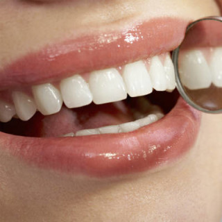 Clareamento dental é opção para dentes manchados - Foto: Getty Images