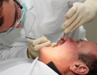 Homem com mucosite oral em tratamento no dentista 