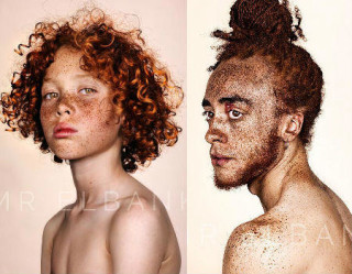 Fotógrafo Brock Elbank lança série valorizando sardas no rosto