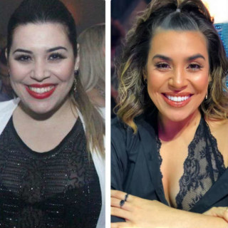 Antes e depois mais recente da cantora sertaneja - Foto: Divulgação/Purepeople