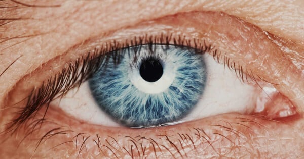 Sífilis no olho causa inchaço do nervo óptico