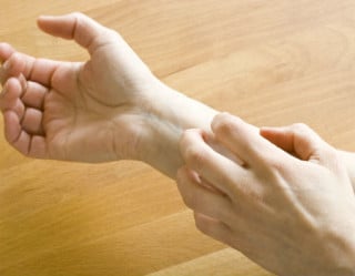 Cuidados com alergias de pele evitam manchas e cicatrizes