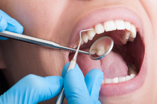 Pessoa limpando os dentes no dentista
