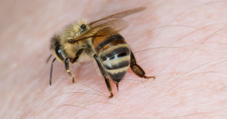 Picada de abelha