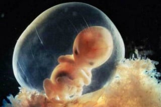 feto-bolsa-liquido-amniotico - Foto: Lennart Nilsson
