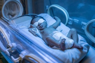 Fototerapia neonatal - Foto: andresr/Getty Images
