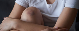 Manchas roxas espontâneas na pele podem ser hemofilia adquirida - Foto: Shutterstock