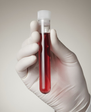 tubo de sangue - Foto: Getty Images