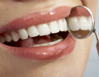 Alinhadores invisiveis consertam os dentes de forma mais estética