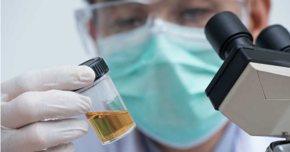 Exame de urina pode substituir papanicolau no futuro, afirma estudo