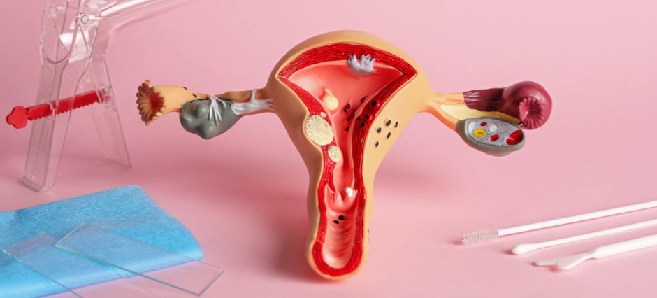 Imagem de útero com fundo rosa e ferramentas
