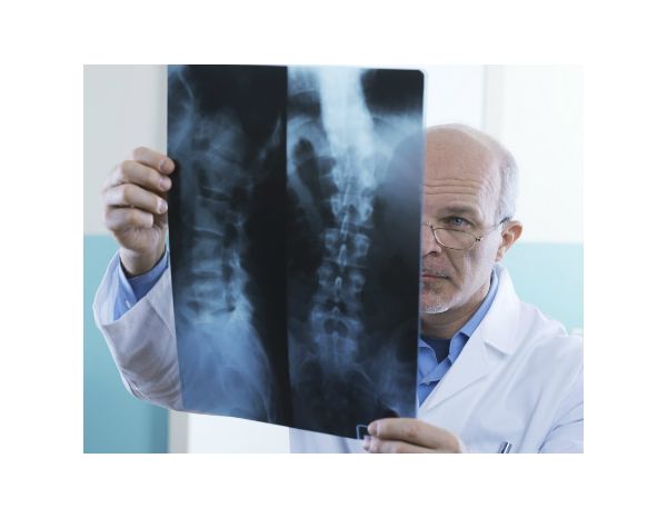 Médico olhando raios-x de paciente com dor na coluna