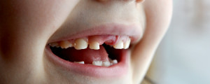 Dente de leite 'reserva' espaço para o dente permanente e deve ser bem cuidado desde o nascimento
