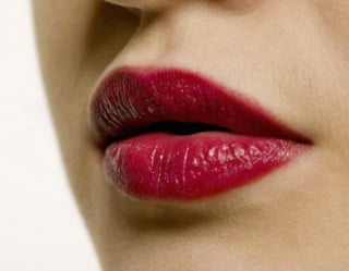 Plástica nos lábios pode ser feita de duas formas