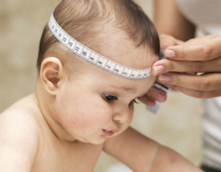 Microcefalia: especialista sugere medida de diâmetro de cabeça ainda menores