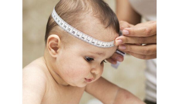 Microcefalia: especialista sugere medida de diâmetro de cabeça ainda menores