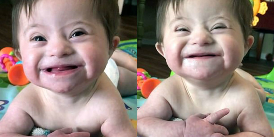 Bebê com Down encanta ao sorrir para mãe que quer adotá-la