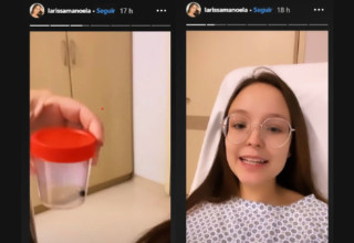 À esquerda, pote com pedra na vesícula retirada da atriz; à direita, atriz comenta sobre a cirurgia - Foto: Reprodução/Instagram