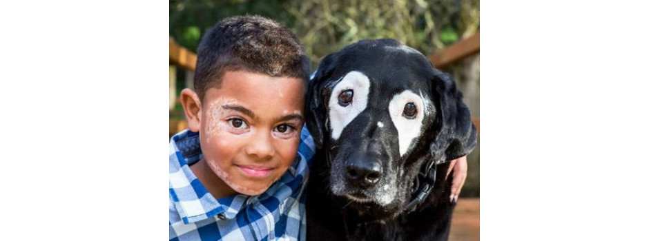 Menino e cachorro com vitiligo se encontram pela primeira vez 