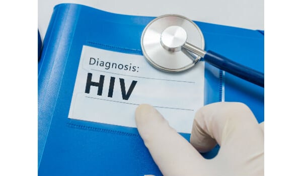 Pesquisa britânica pode estar próxima de descobrir cura para o HIV