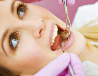 Mulher passando selante dentário no dentista
