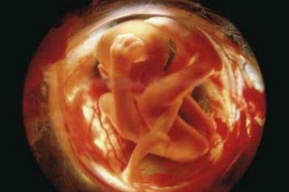 feto-26-semanas - Foto: Lennart Nilsson