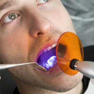 Clareamento dental ativado por luz - Foto: Getty Images