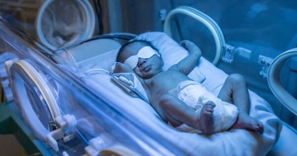 Bebê fazendo fototerapia neonatal