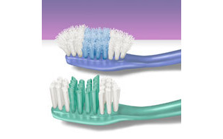 Quando gasta (na foto, a escova de cima), a escova pode danificar a gengiva. Use uma escova dental nova a cada três meses ou troque quando perceber que as cerdas estão deformadas ou gastas. 