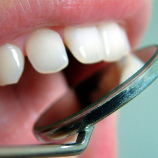 hipersensibilidade dentinária